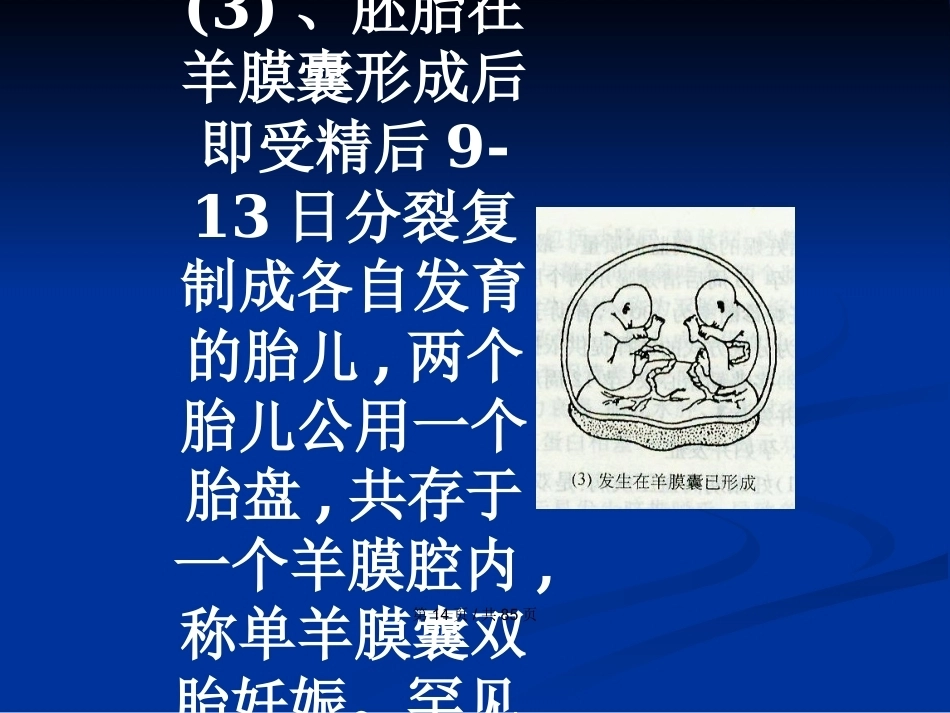 双胎妊娠与巨大胎儿PPT学习教案_第14页