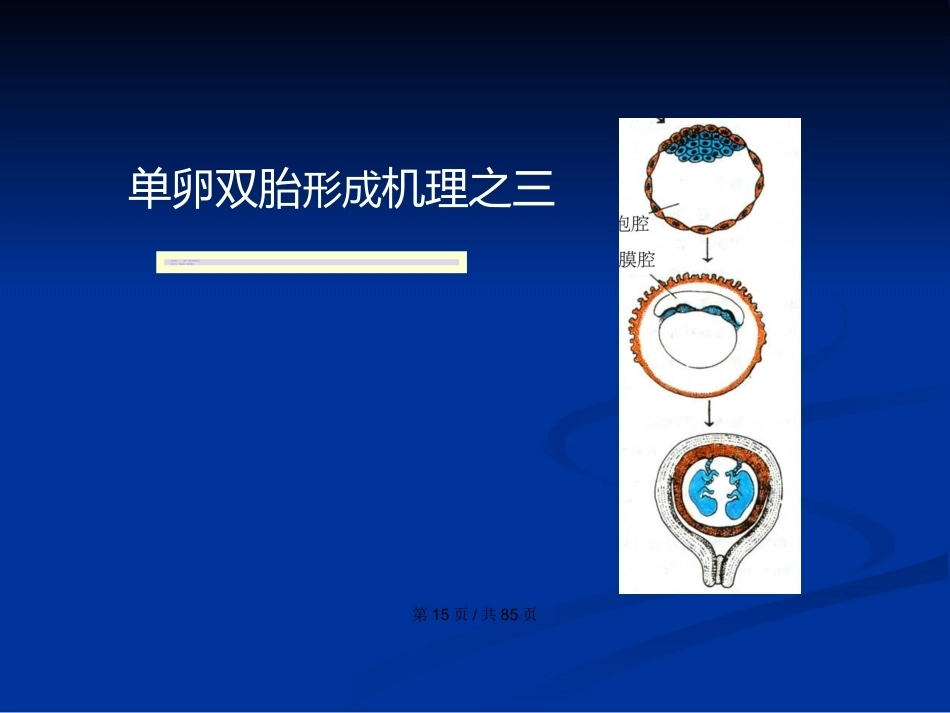 双胎妊娠与巨大胎儿PPT学习教案_第15页