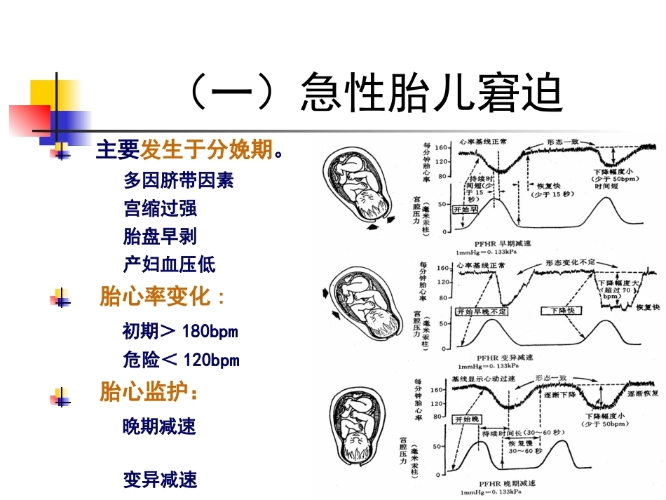 胎儿宫内窘迫_第12页