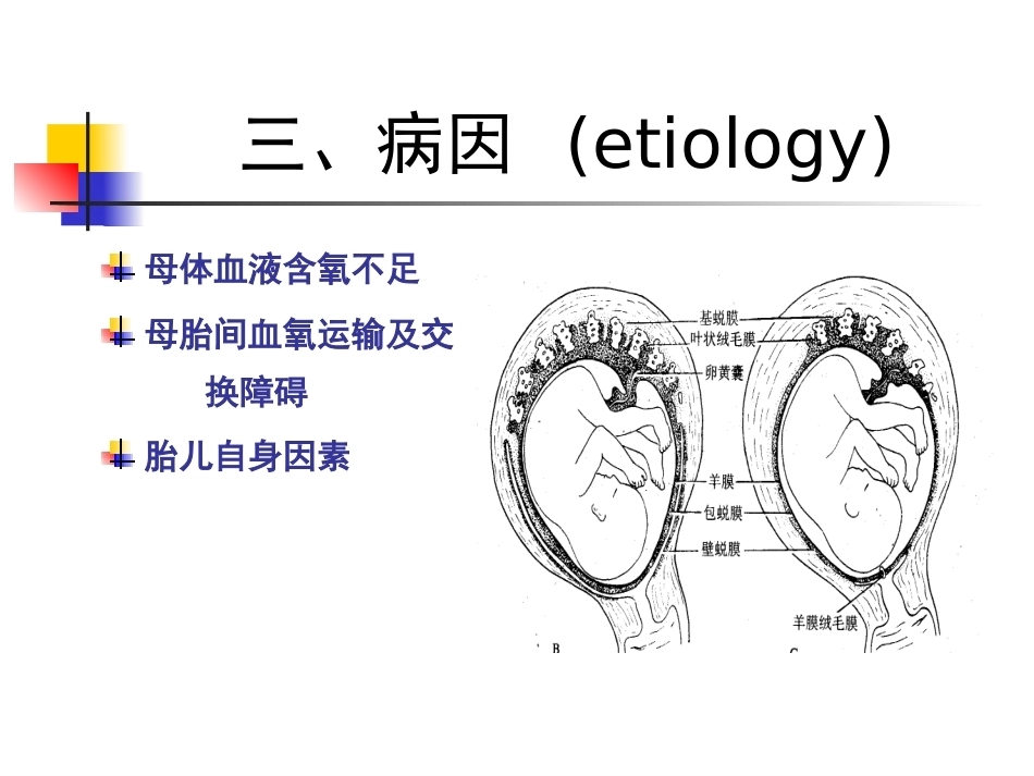 胎儿宫内窘迫_第7页