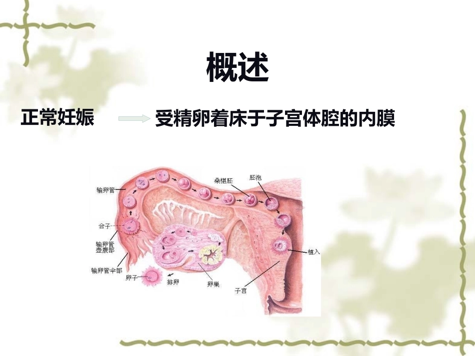输卵管妊娠中以壶腹部妊娠最多_第4页