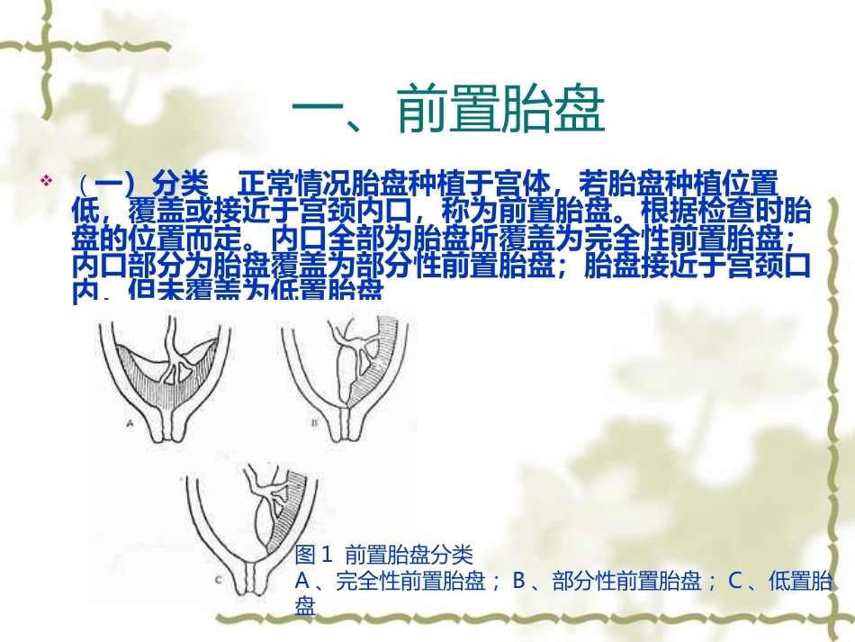 妊娠晚期出血(产前出血)_第3页