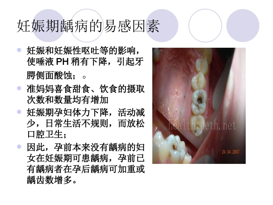 妊娠期口腔保健知识普及_第4页