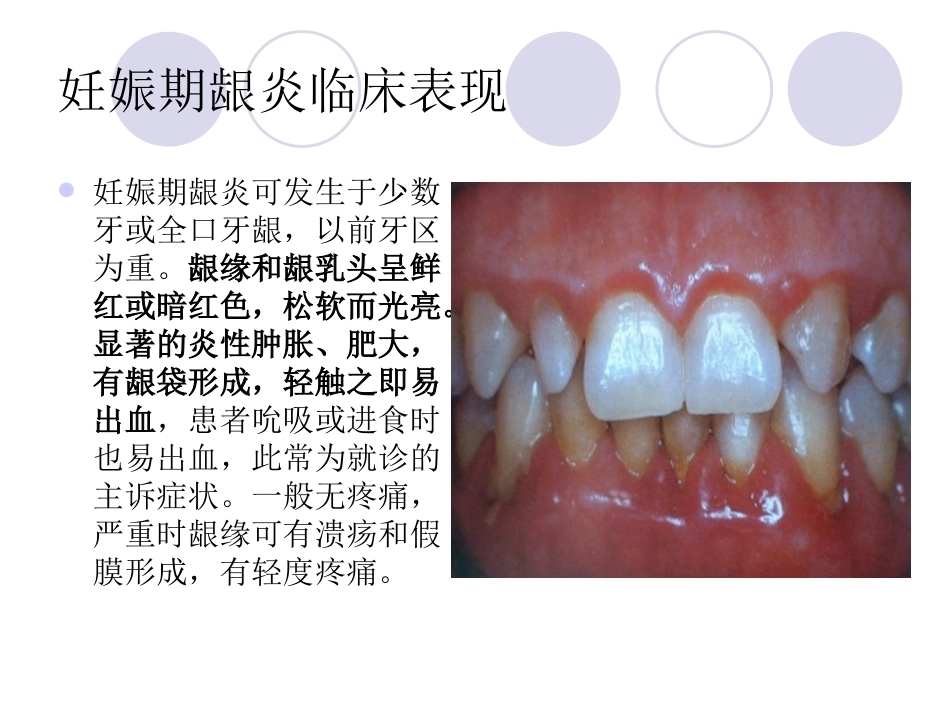 妊娠期口腔保健知识普及_第7页