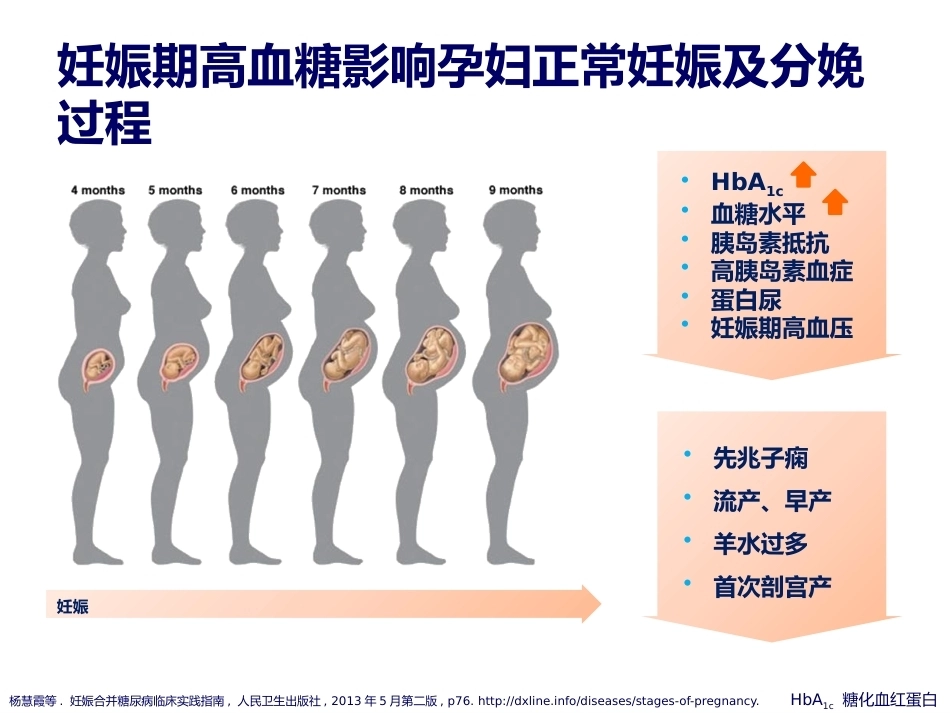 妊娠期糖尿病诊断标准的变迁_第7页