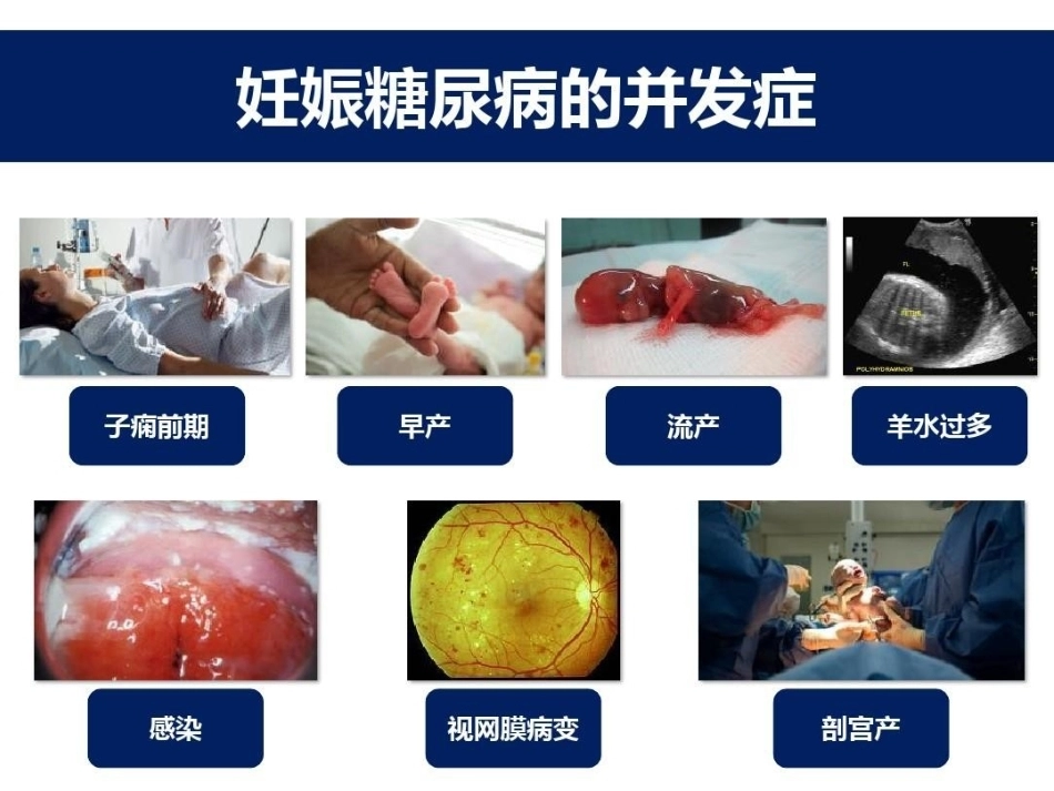 妊娠期糖尿病的胰岛素治疗_第7页