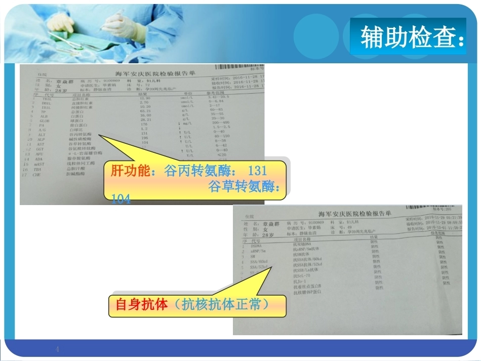 系统性红斑狼疮SLE合并妊娠PPT课件_第4页
