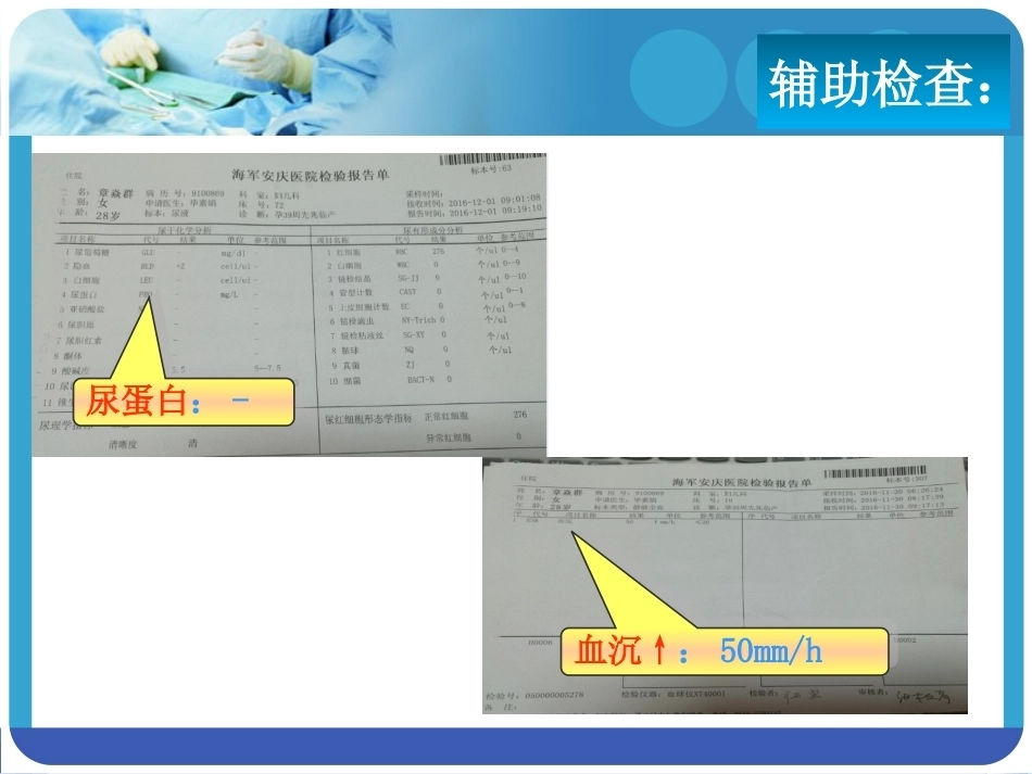 系统性红斑狼疮SLE合并妊娠PPT课件_第5页