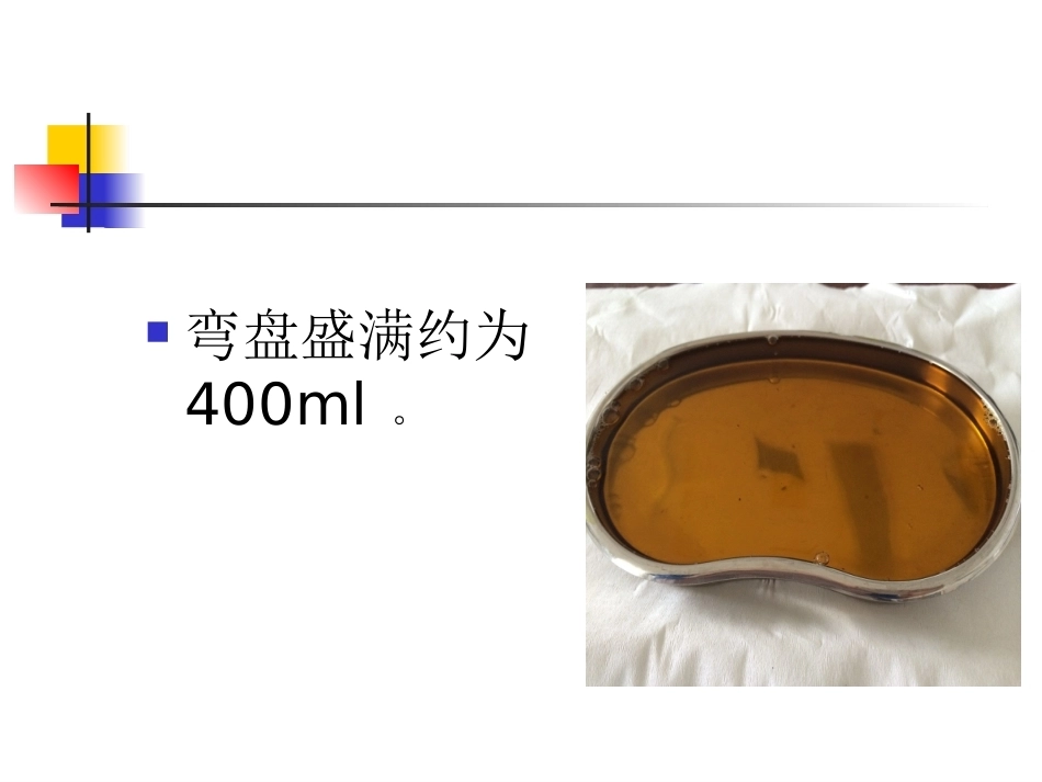 如何精确计算产后出血量_第14页
