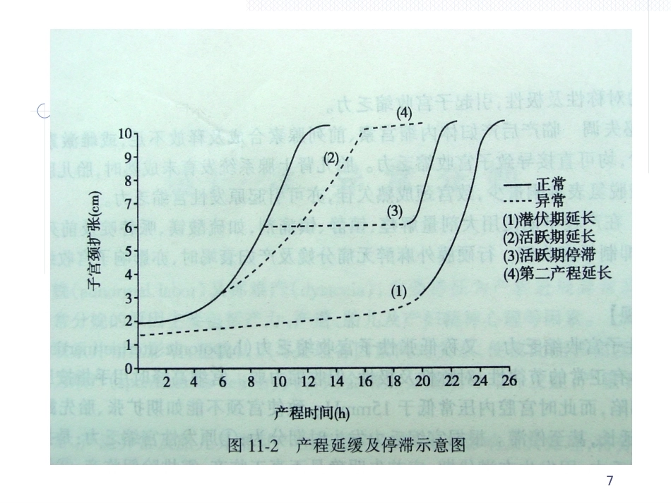 异常分娩(英文)_第7页