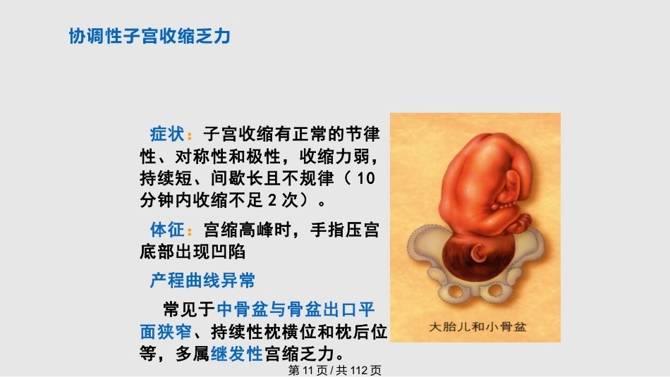 异常分娩PPT课件_第11页