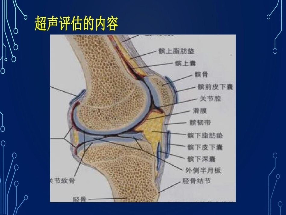 血友病关节超声检查的必要性_第12页