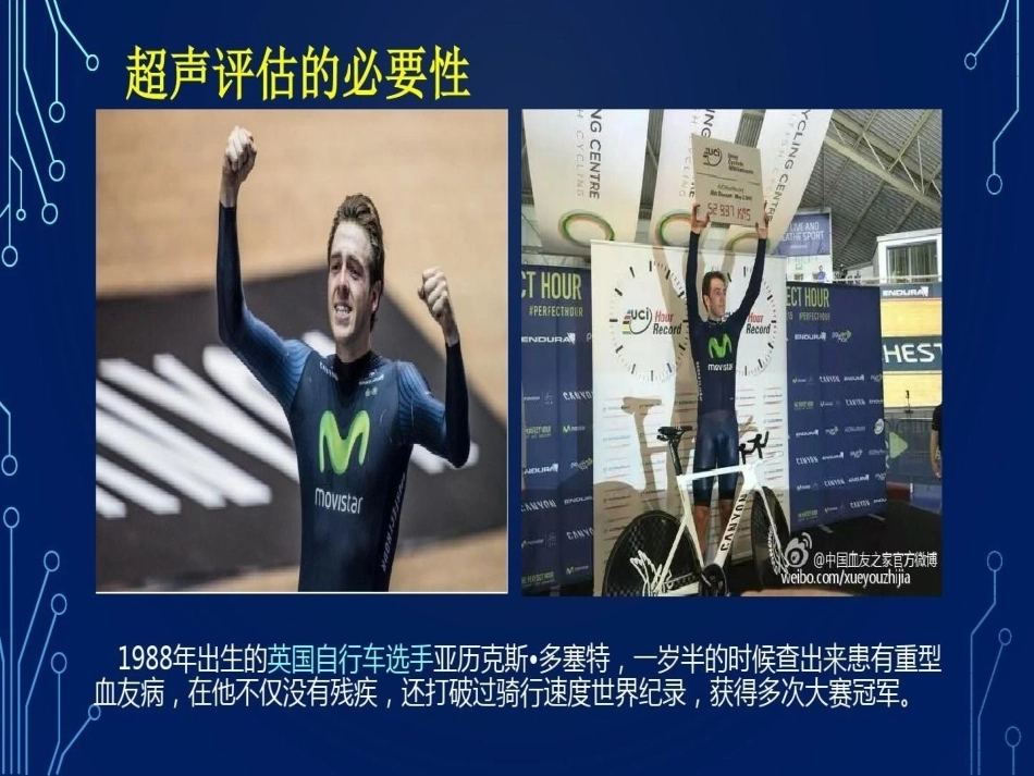 血友病关节超声检查的必要性_第3页