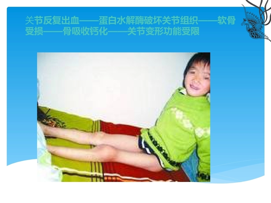 血友病介绍_第13页