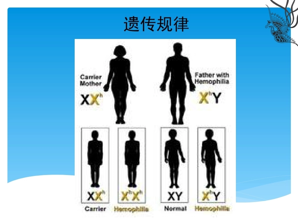 血友病介绍_第7页