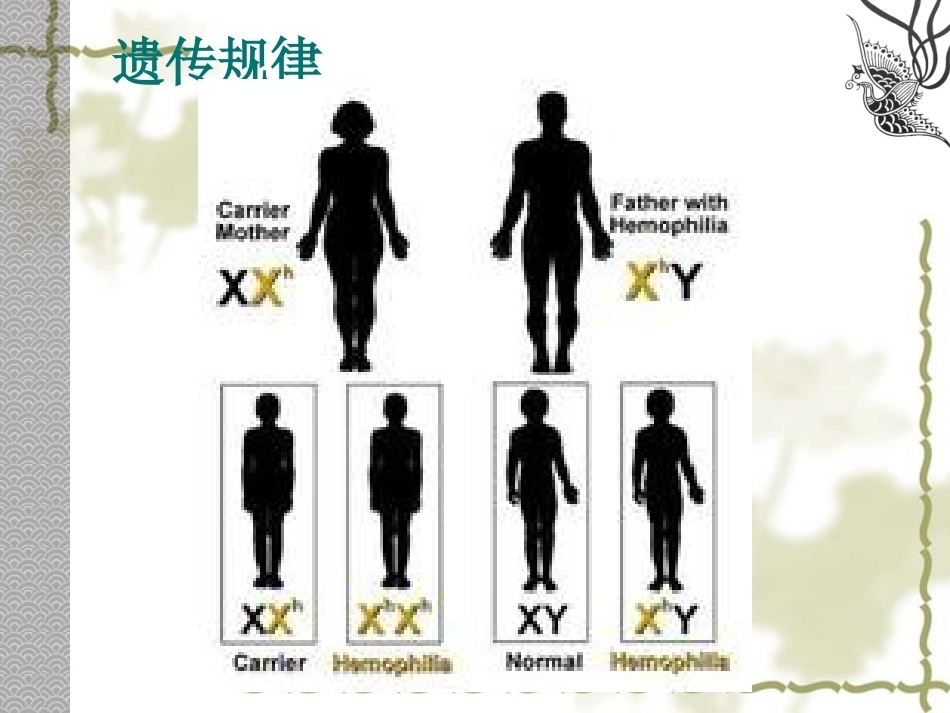 血友病 PPT课件_第8页