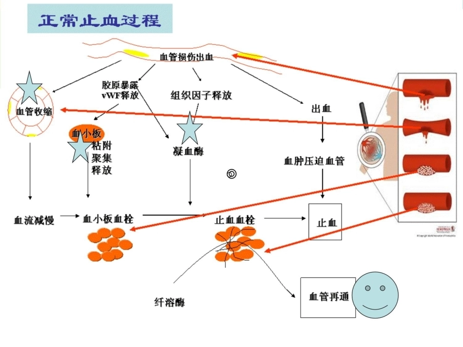 血友病医学课件_第4页
