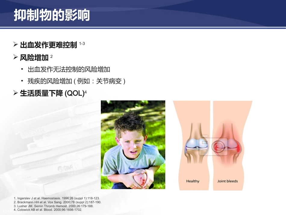 血友病抑制物的产生与防治策_第4页