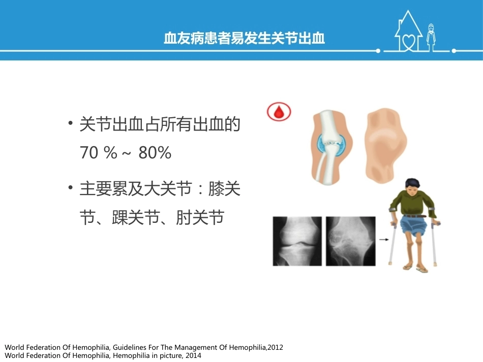 血友病规范化治疗及关节保护_第13页