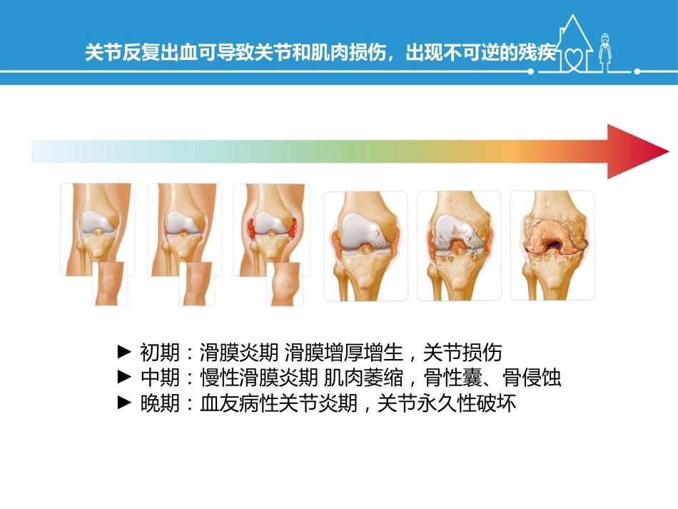 血友病规范化治疗及关节保护_第14页