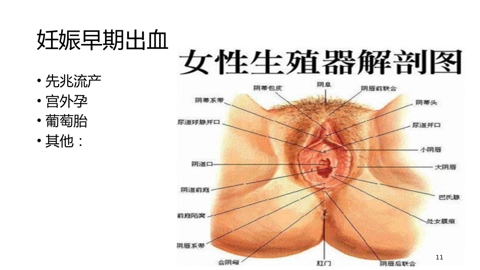 妊娠期异常的处理妊娠出血_第11页