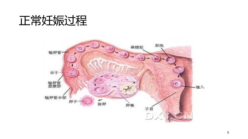 妊娠期异常的处理妊娠出血_第5页