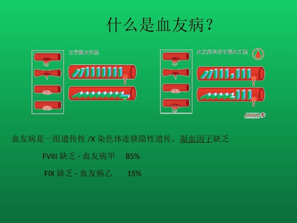 血友病与血管性血友病的诊断与治疗_第6页