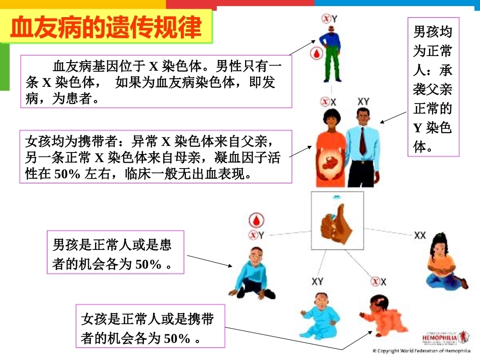 血友病综合治疗_第10页