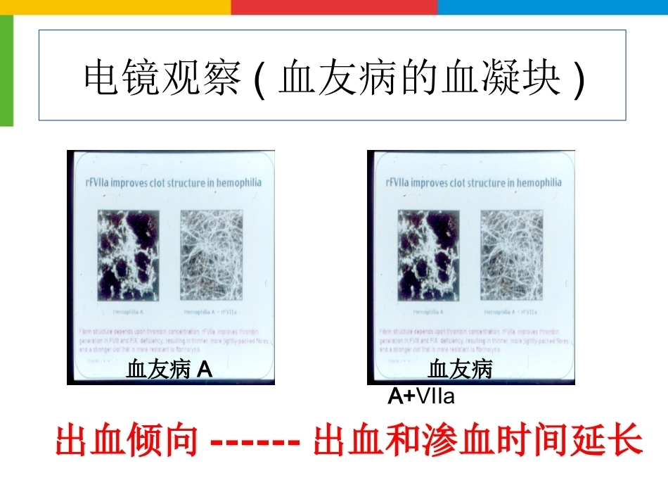 血友病综合治疗_第14页