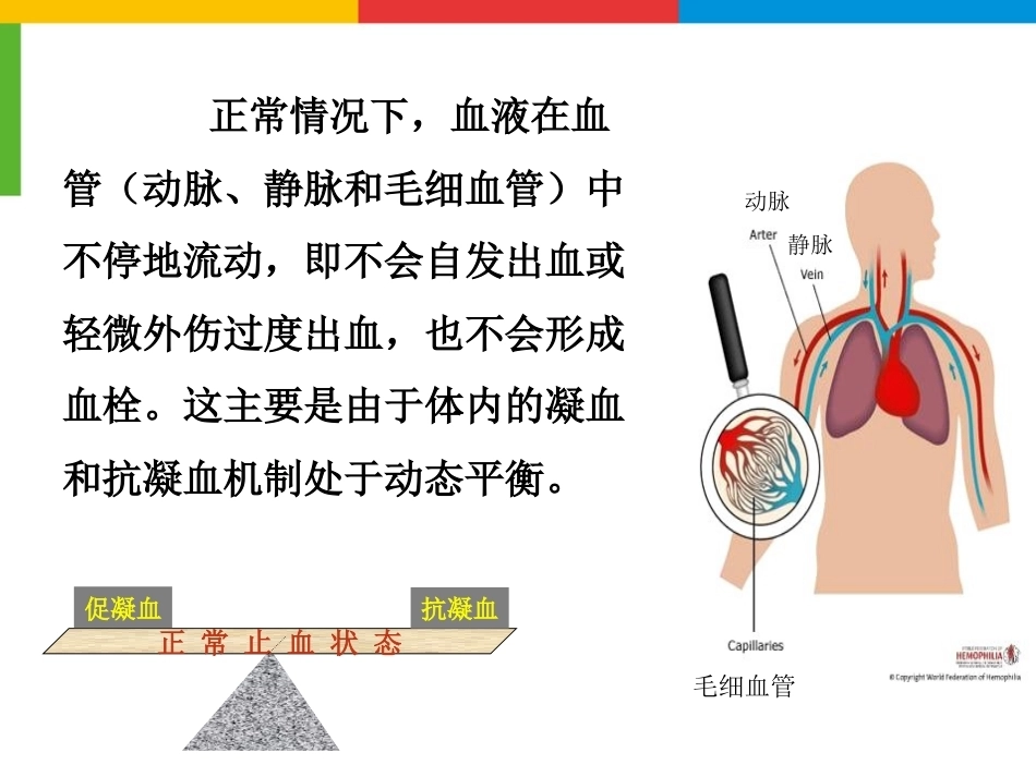 血友病综合治疗_第2页