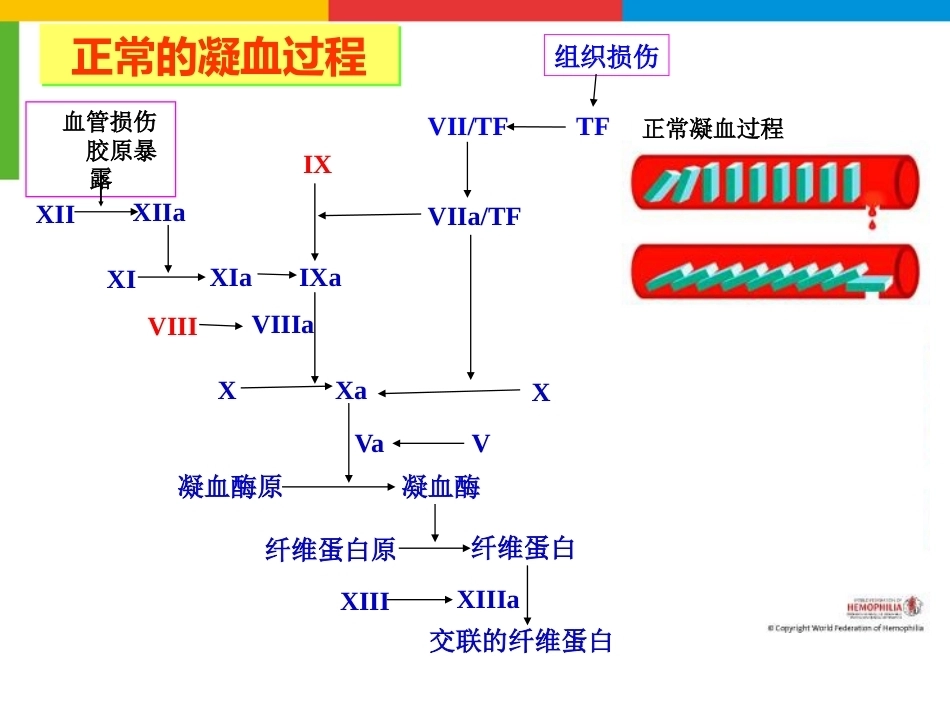 血友病综合治疗_第5页