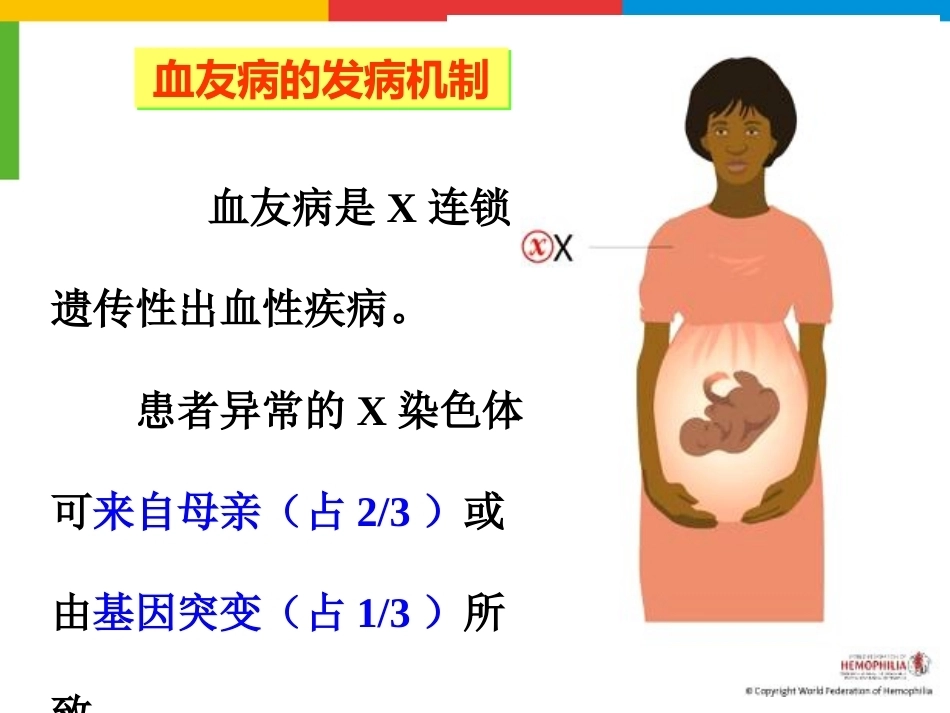 血友病综合治疗_第9页