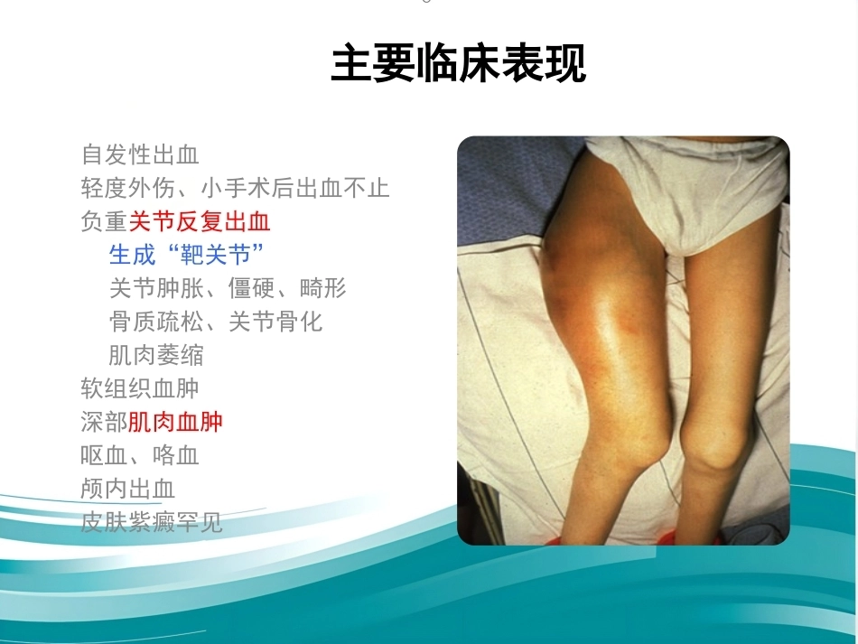 血友病临床路径_第4页