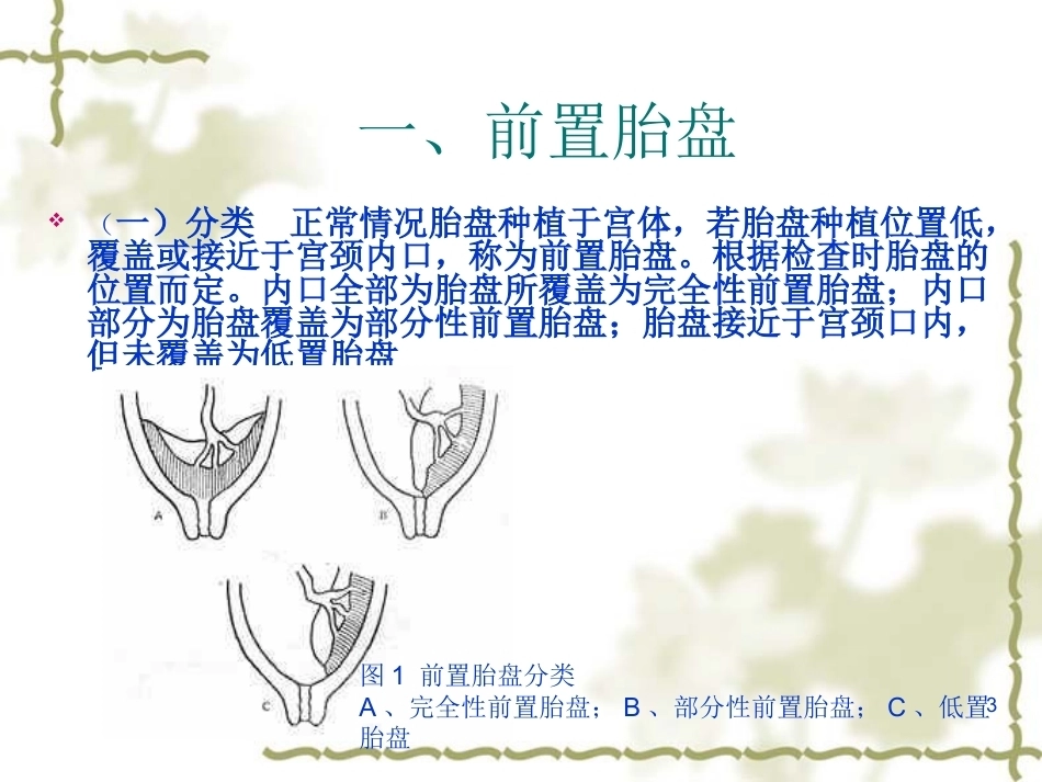 妊娠晚期出血产前出血_第3页