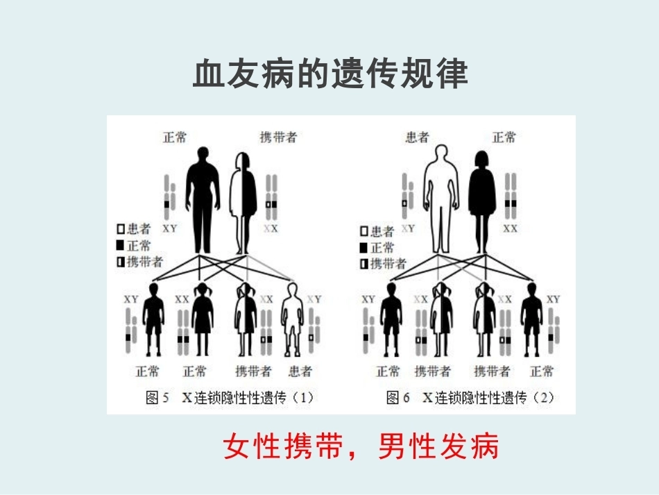 血友病性骨关节病_第3页