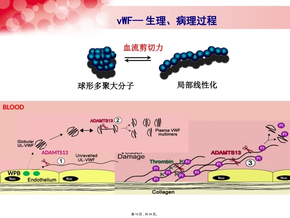 血管性血友病_第15页