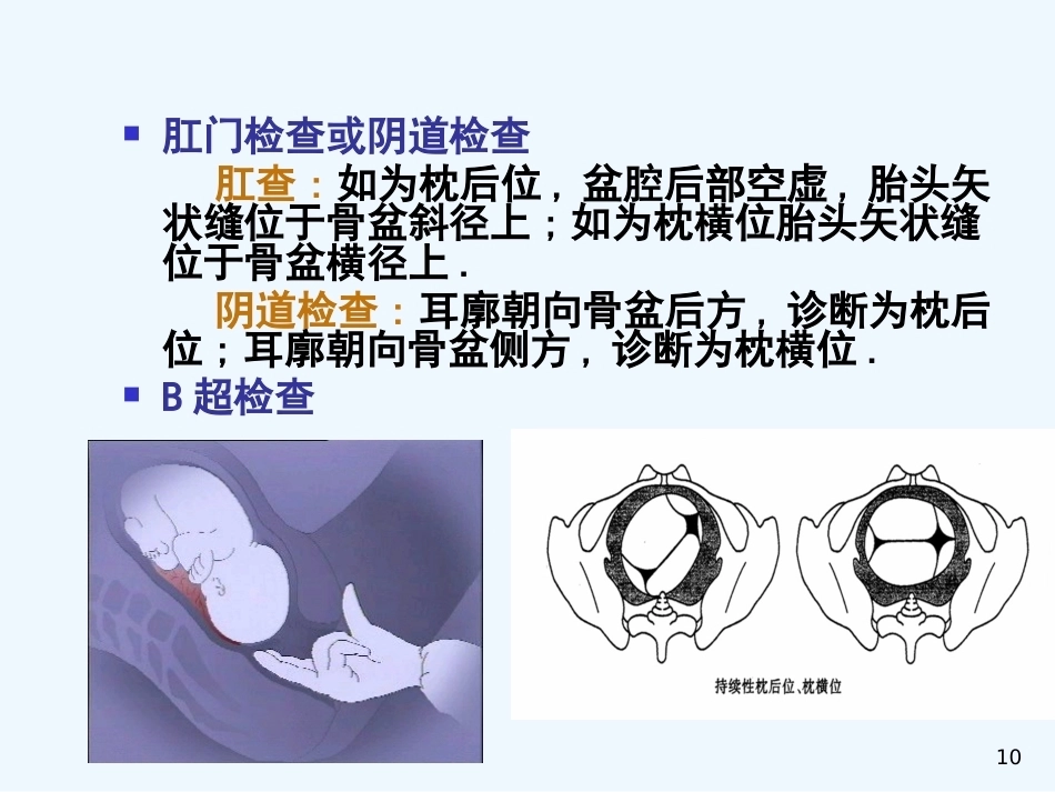 异常分娩胎位异常_第10页