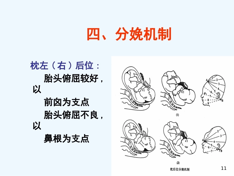 异常分娩胎位异常_第11页