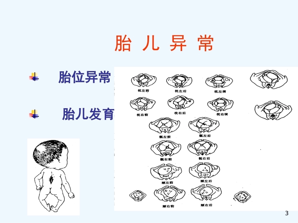 异常分娩胎位异常_第3页