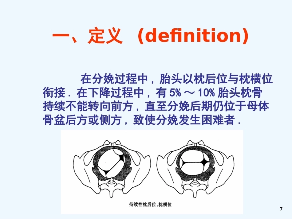 异常分娩胎位异常_第7页