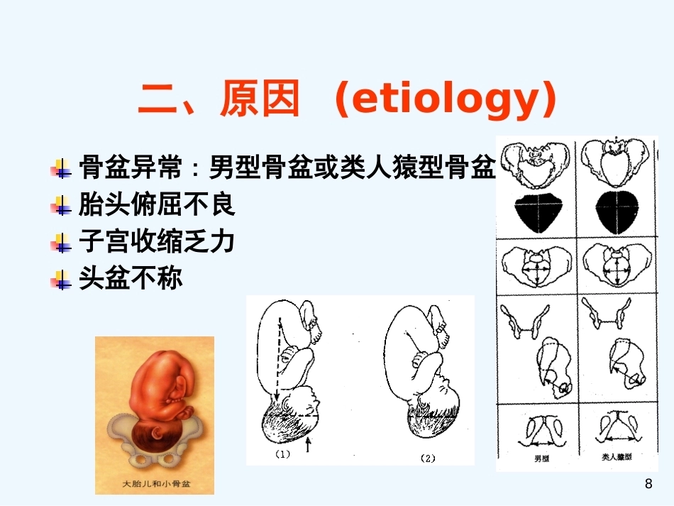 异常分娩胎位异常_第8页
