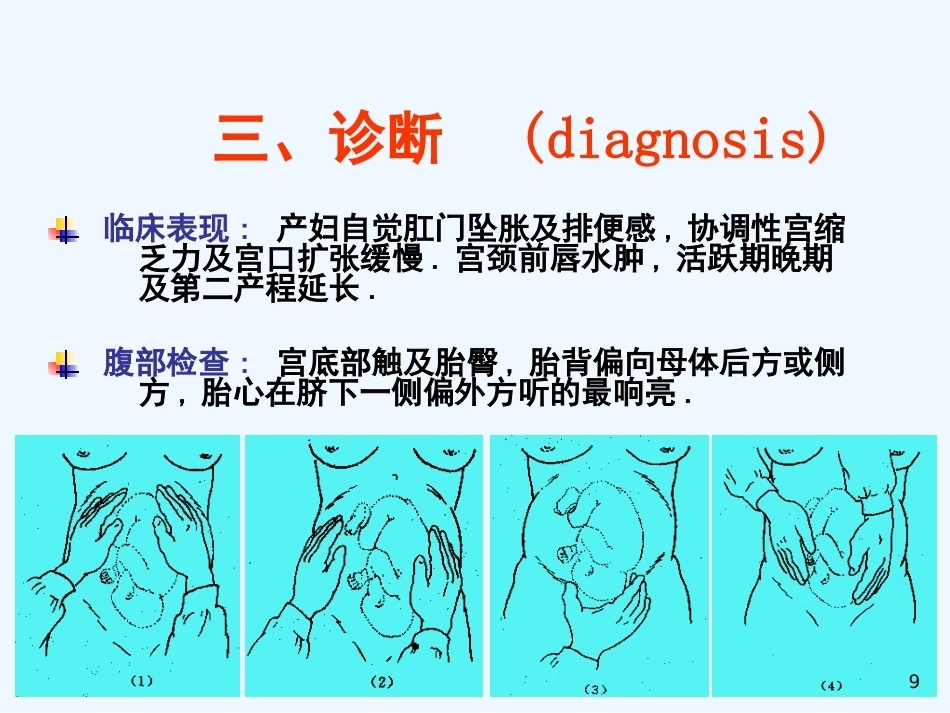 异常分娩胎位异常_第9页