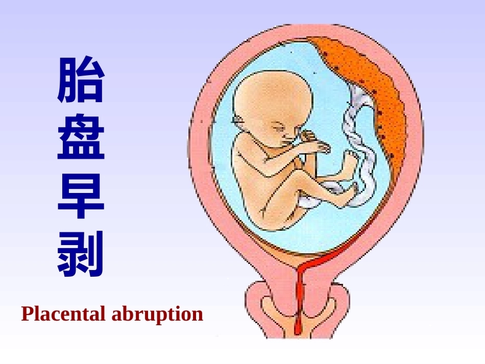 妊娠晚期出血性疾病_第11页