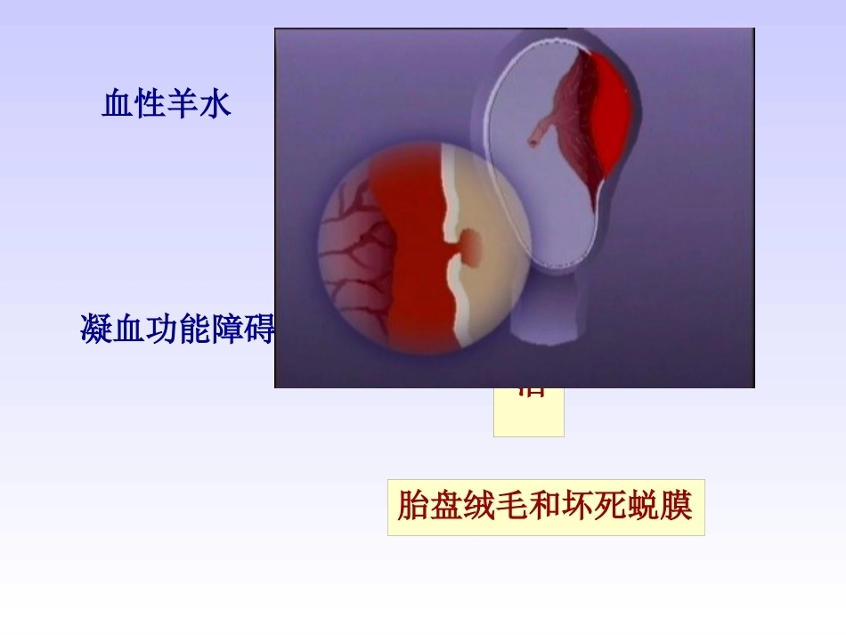 妊娠晚期出血性疾病_第15页