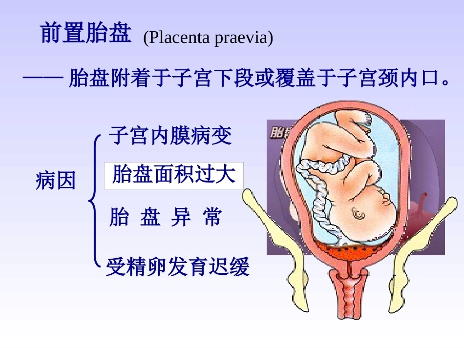 妊娠晚期出血性疾病_第2页