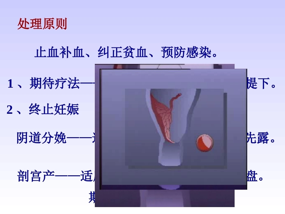 妊娠晚期出血性疾病_第4页