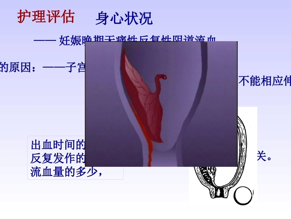 妊娠晚期出血性疾病_第5页