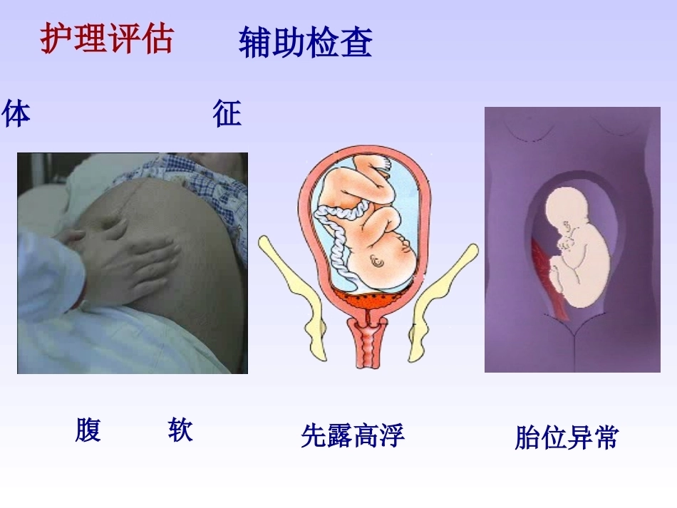 妊娠晚期出血性疾病_第6页