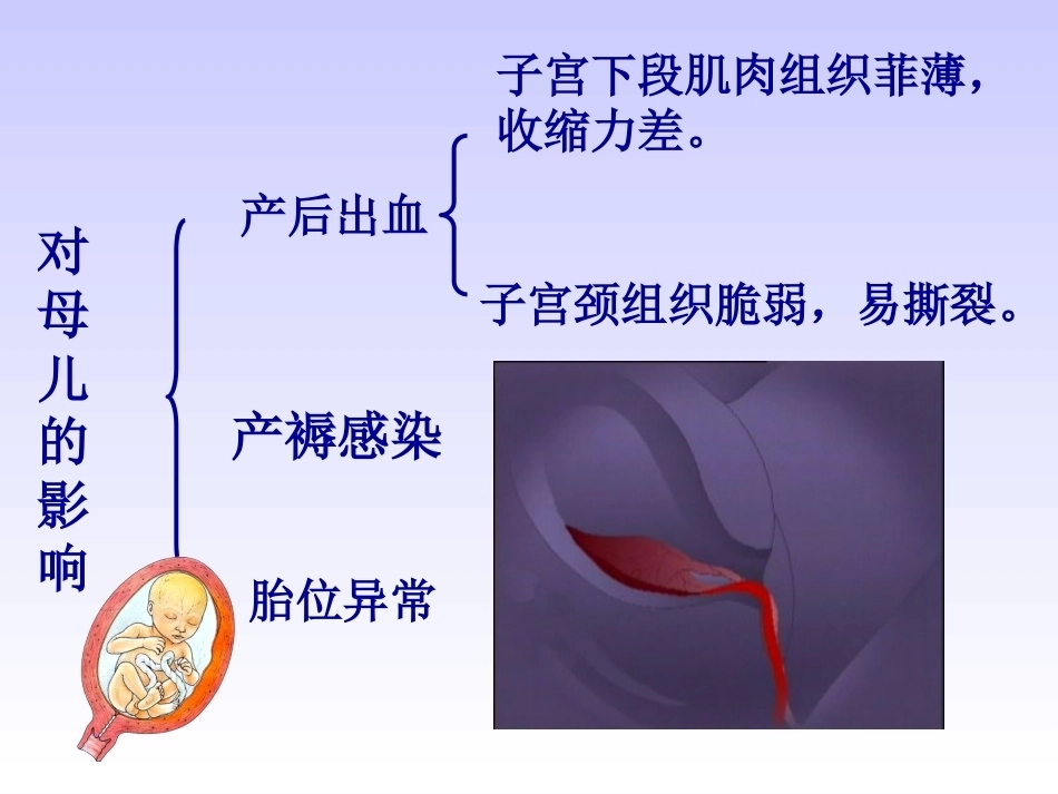 妊娠晚期出血性疾病_第8页