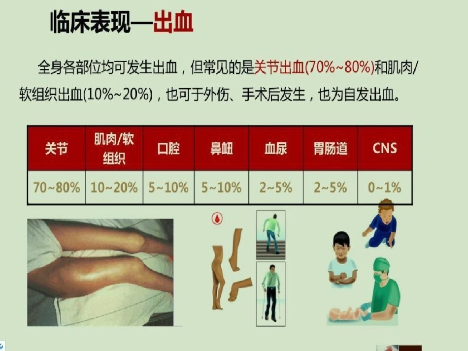 血友病 患者科普3_第12页